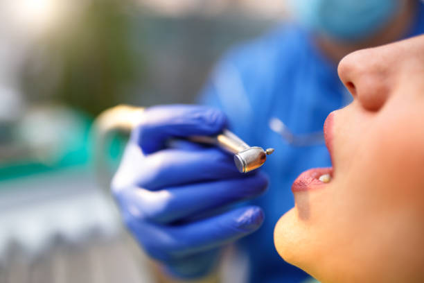 Dental Bonding in Florida City, FL